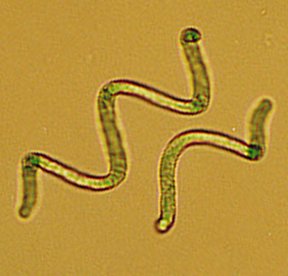 Spirulina: O Superalimento da NASA que Você Precisa Conhecer (2026) – Dica Suplementos Spirulina: O Superalimento da NASA que Você Precisa Conhecer (2026) - imagem ilustrativa sobre benefícios, cuidados e suplementação