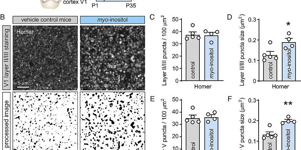 Inositol — Suplemento para SOP e Ansiedade